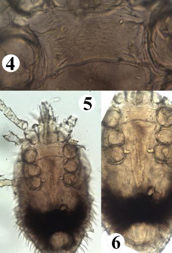 Ornithonyssus bacoti
